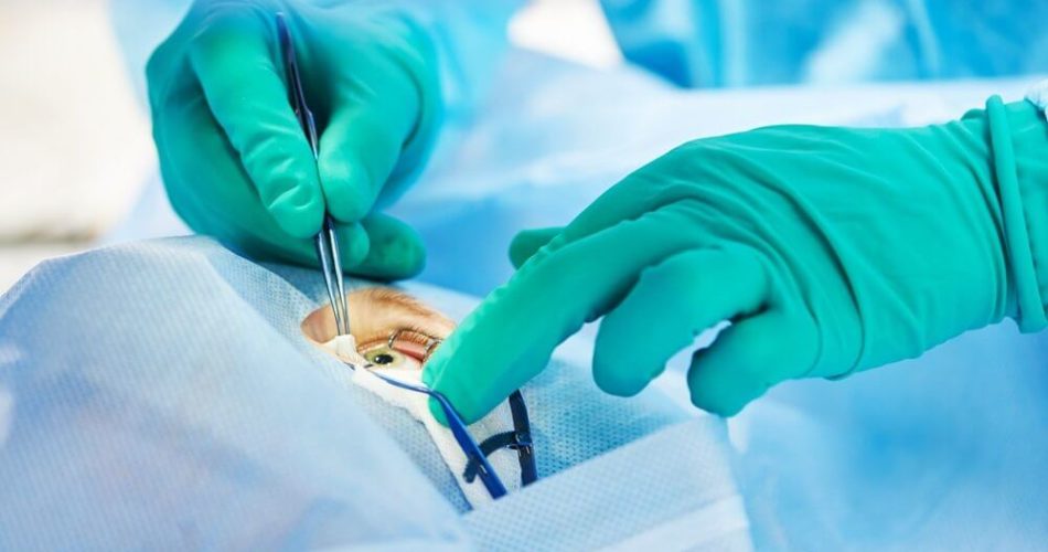 operaciya pri astigmatizme 950x500 - Лунный календарь операций апрель 2021